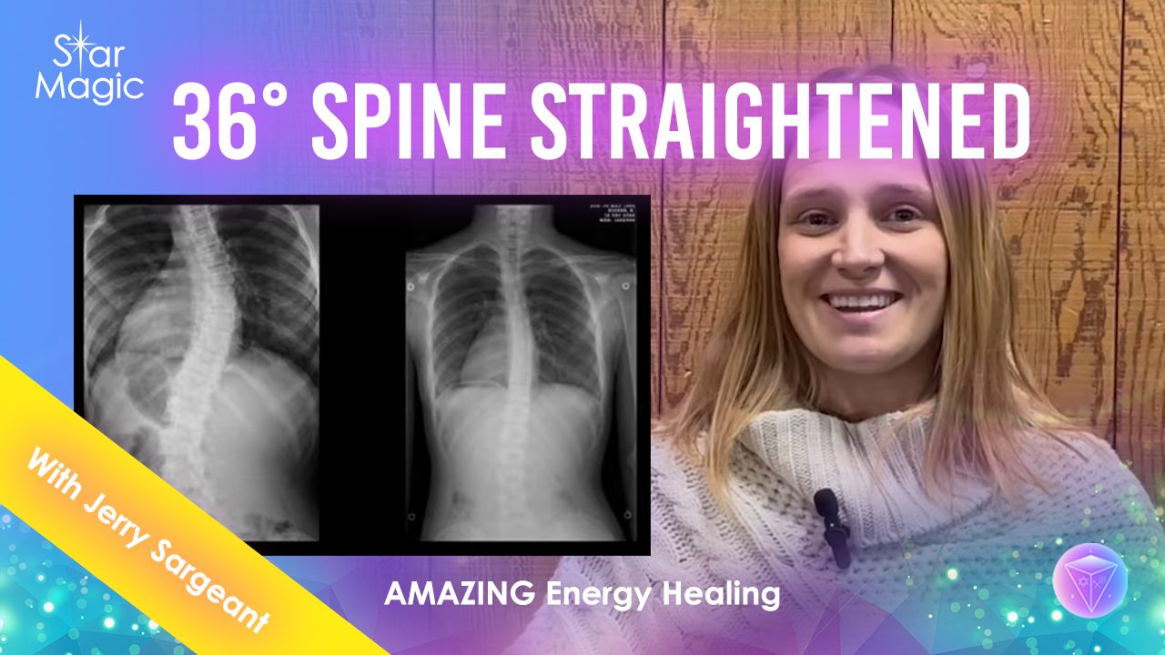 My Spine Is Now Straight Testimonial | Jerry Sargeant